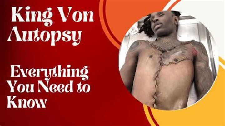 King Von Autopsy Report: Uncovering The Tragic Truth